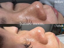 ナチュールムーン(Nature moon.)/毛穴洗浄