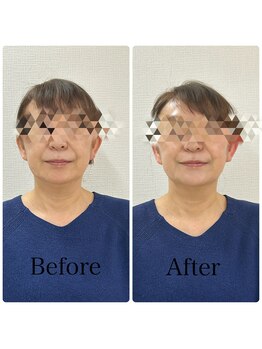 ブプラ 松本店(BUPURA)/