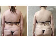 スリーピングビューティー(Sleeping Beauty)/