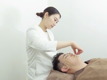 グラン治療院 東京の雰囲気（お悩みに合せてお顔、頭に100本前後の鍼を行います！）