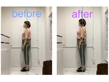 レピア 夙川本店(Lepia)/頭から足まで一直線に整いました