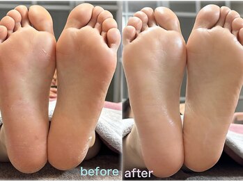 ヴィーナ(VEAN)の写真/足裏の角質を綺麗にケアして、しっとりなめらかな清潔感のある足に。プライベート空間で贅沢なひとときを♪