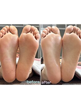 角質ケアができるサロン