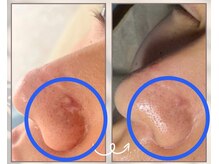 エリュクス(et Luxe)/凹凸も薄く！