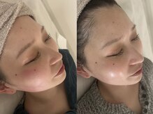 リリー(Lily)/プラピール