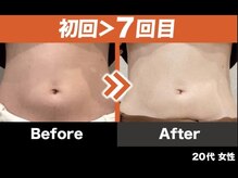 みらい平オレンジ整骨院/ダイエットコース