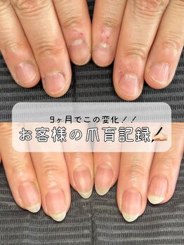 ル ソレイユ(Le soleil)/お客様の爪育記録