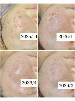 ブラックボックス(BLACK BOX)/10代女性のお客様