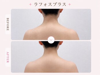 パールプラス 会津若松店/鎖骨/肩まわり/肩甲骨もすっきり