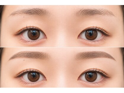 アルボーテ ルジェ 芦屋(Art BeAute' ROUGET)の写真