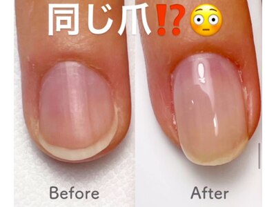 自分の爪と肌が美しく育めるケアで、自慢の指先に！乾燥ケアも◎