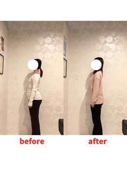 ナオル整体 福岡香椎院(NAORU整体)/20代女性施術事例【反り腰】