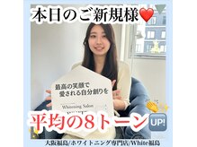 ホワイトニングサロン ホワイト(WHITE)/セルフホワイトニング/大阪/福島