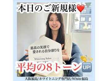 ホワイトニングサロン ホワイト(WHITE)/セルフホワイトニング/大阪/福島
