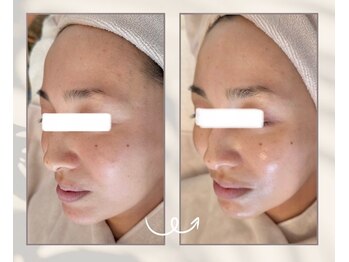 エリュクス(et Luxe)/プラズマのみでもこんなに変化