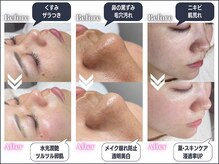 鼻の黒ずみ毛穴汚れをwaxでゴッソリOFFします！爽快感◎透明感UP