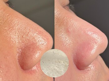 ルーナジェーナ(Luna llena)/