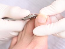 フットメンテ 巻き爪矯正センター 南浦和/３、施術の流れ　