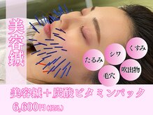 モンダロ(MONDARO)