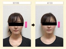 コロナ整体 神宮前院(Corona.整体)/小顔 Before&After〈原宿/小顔〉