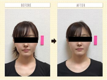 コロナ整体 神宮前院(Corona.整体)/小顔 Before&After〈原宿/小顔〉