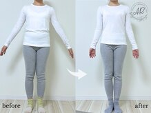 エーアール(AR)/【Before/After】12回目