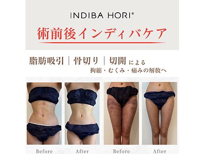 インディバ ホリ ナゴヤ ハニーズビューティー(INDIBA HORI NAGOYA Honey’s beauty)の写真