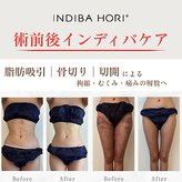 インディバ ホリ ナゴヤ ハニーズビューティー(INDIBA HORI NAGOYA Honey’s beauty)