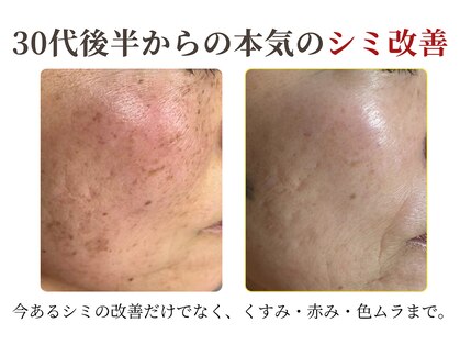 ボータン 恵(Beau Temps)の写真