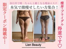 リアンビューティー(Lien Beauty)