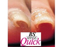エンズネイル(Enn's nail)の雰囲気（巻き爪で悩んでいる方に見た目も痛みも緩和）