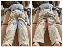 ルミナフローム(LuminaFlowm)の雰囲気（歪みが整いまっすぐになります）