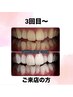 【3回目～の来店の方限定！】美白セルフホワイトニング 40分照射 ¥6700