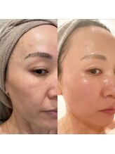 アバンギャルド(Avantgarde)/