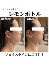 トリニティスペース(TrinitySpace)/レモンボトルビフォーアフター