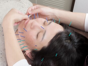 アリッシュ(ARiSH)/美容鍼