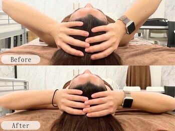 ルルミリ 心斎橋(Lulumili)/すっきり小顔矯正ケア