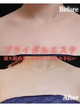 サンティエ(Santie)/