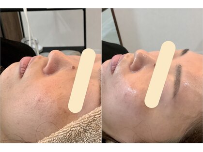 エスポワール(espoir)の写真