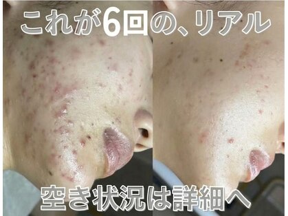 ソアスキン(SOAskin)の写真