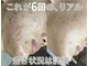 ソアスキン(SOAskin)の写真