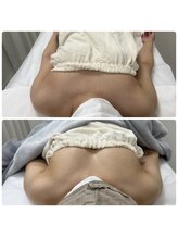 シアンビビ(Cyaan bibi)/バストアップ