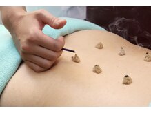 荻窪接骨院 荻窪治療室/意外と知られていないお灸の効果