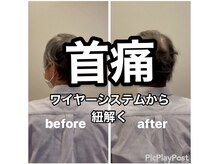 カワル整体 上通り院/首痛～ワイヤーシステム～