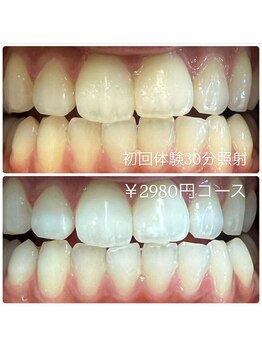 ホワイトニングルーム 川崎店(WhiteningRoom)/ホワイトニング/川崎　