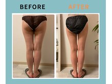 ディーメヴィ(D.MAVIE)/なかなか痩せない脚もお任せ