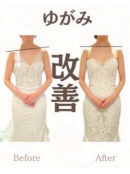 クレール整体院/肩の盛り上がり解消◎