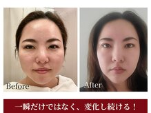 ユルフワ サロン(yurufuwa salon)の雰囲気（体から整える小顔）