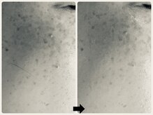 エフェクト 塚口店(effect)/Before After