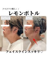 トリニティスペース(TrinitySpace)/レモンボトルビフォーアフター